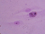 cellules Xerodermiques (X100)